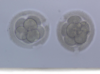 Assisted Hatching (AHA) (Yardmla Yuvalama) 