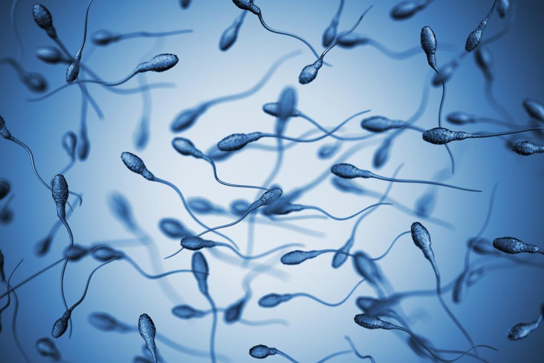 Erkek nfertilitesi Nedenleri 